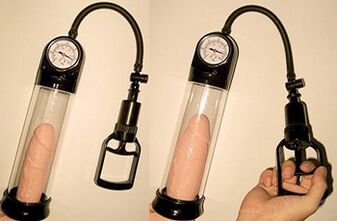 Penis enlargement from 3 to 4 cm in length in 1 day using a vacuum pump